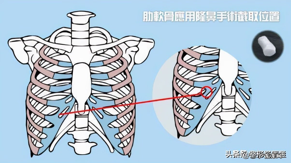隆鼻手术的危害性 隆鼻手术的风险有哪些