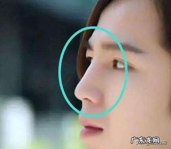 隆鼻手术的危害性 隆鼻手术的风险有哪些