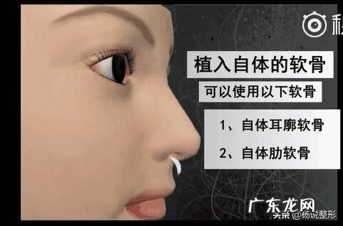 隆鼻手术的危害性 隆鼻手术的风险有哪些