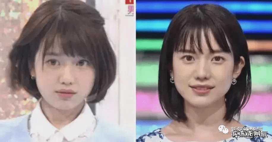 牙膏脸真实 牙套脸