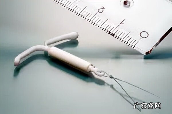 爱母环多少钱一个 上个节育环大约多少钱