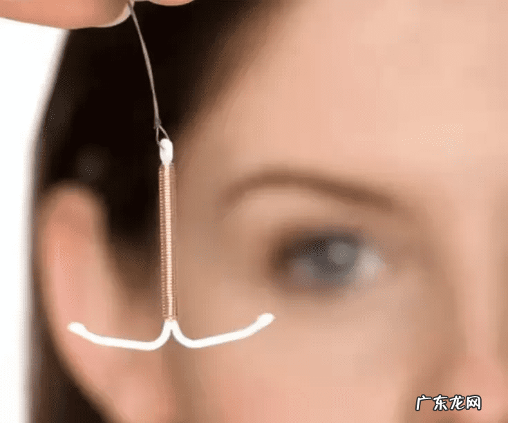 爱母环多少钱一个 上个节育环大约多少钱