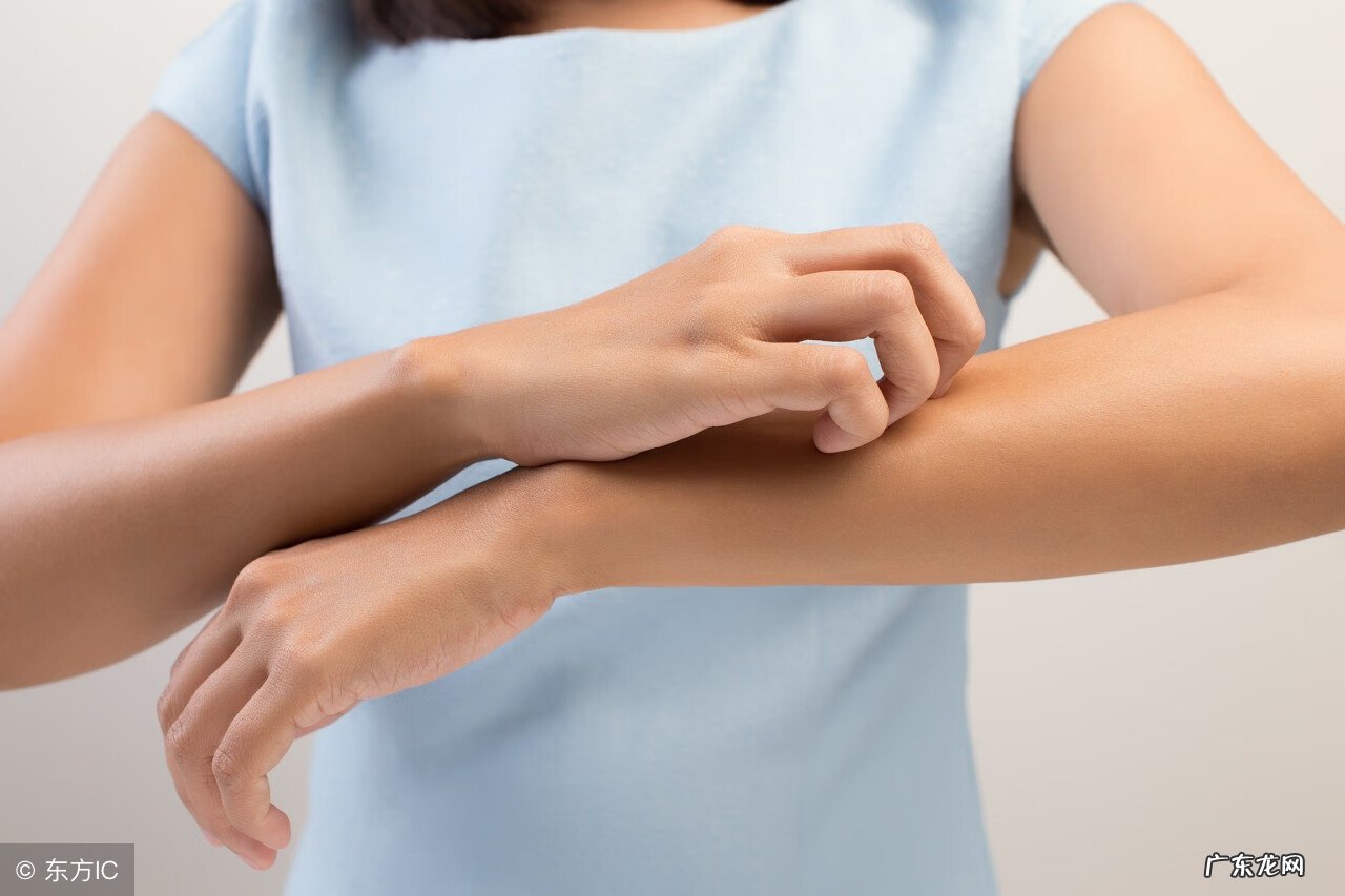 手上湿疹原因 手部湿疹图片