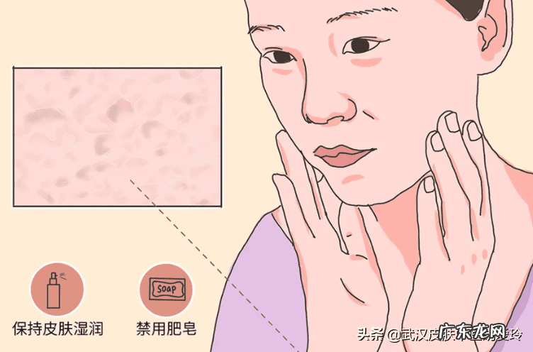 皮肤角质硬化症 角质硬化是怎么造成的?