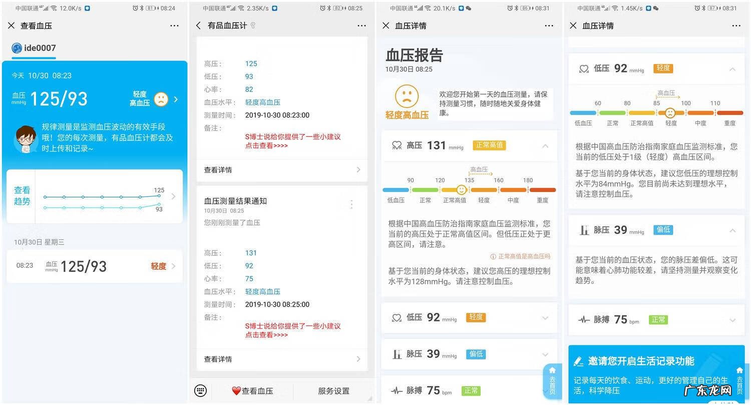 买欧姆龙血压计哪款好 欧姆龙血压计哪款好?