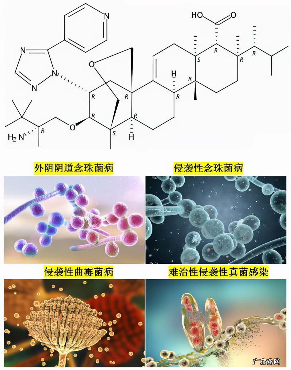 白色念珠菌吃什么药能根治 白色念珠菌吃什么药好使