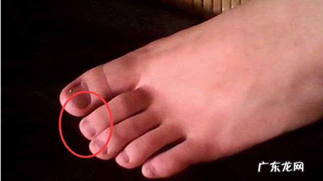 小脚趾很小说明什么 小脚趾很长代表什么