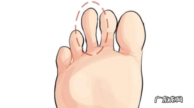 小脚趾很小说明什么 小脚趾很长代表什么