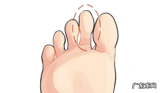 小脚趾很小说明什么 小脚趾很长代表什么