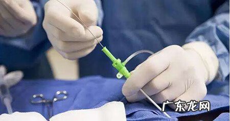 宫腔粘连手术大概多少钱 宫腔粘连手术费多少