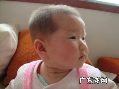 风疹的特点 风疹病毒