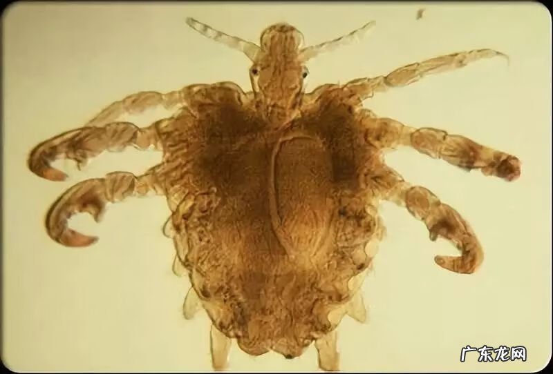 疥疮结节用什么药膏最好 疥疮结节怎么用药