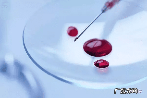 艾滋病一个月必有的症状 艾滋的早期症状表现