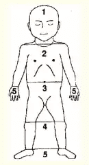 出生婴儿黄疸正常范围 婴儿黄疸图片