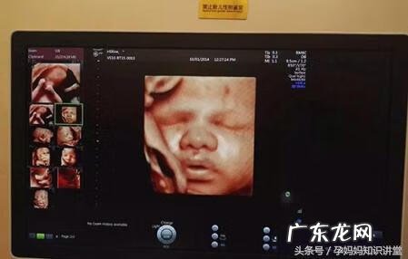 生儿子的四维彩超图片 双胞胎四维彩超的最佳时间