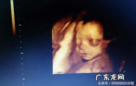 生儿子的四维彩超图片 双胞胎四维彩超的最佳时间