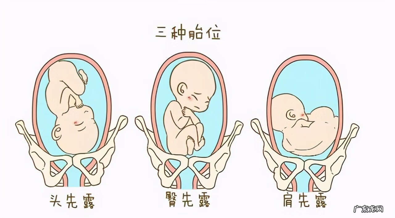 头位loa的胎儿图解 胎位loa是什么意思啊