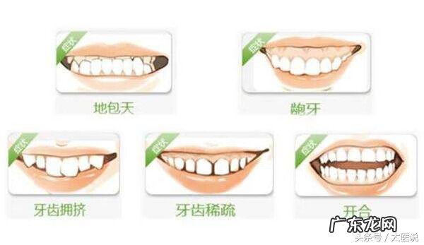 牙齿整形都可以怎么整 整形牙齿