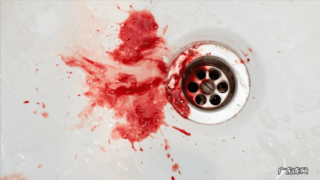 大便时突然出大量鲜血 排便时有鲜血滴出,提示