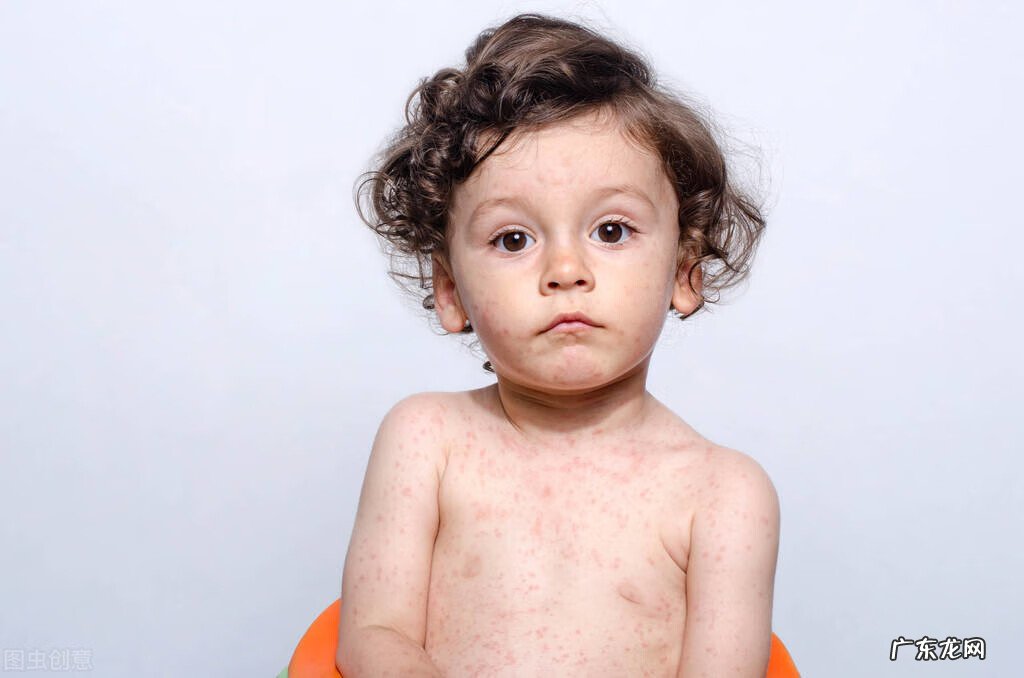 过敏性紫癜几年后会复发吗 过敏性紫癜复发的原因