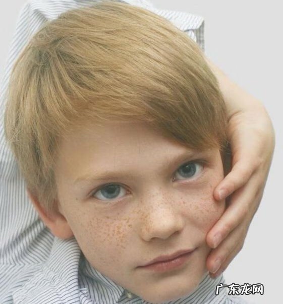 激光祛斑的费用大概多少 色斑的治疗