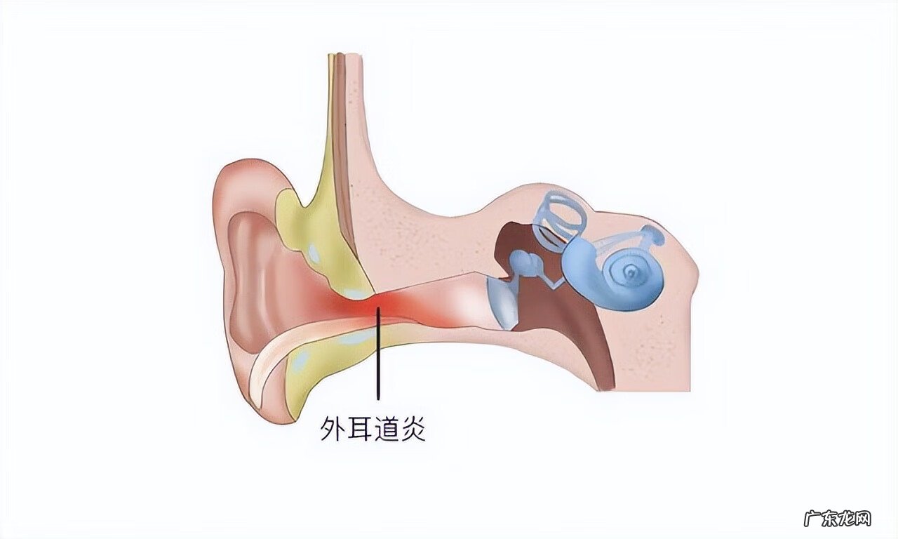 耳朵后面长了一堆小疙瘩 耳朵后面长疙瘩是怎么回事