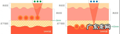 乳房下垂怎么提升上去 胸部松弛下垂怎么办