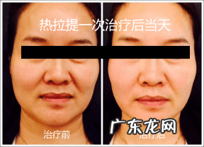 乳房下垂怎么提升上去 胸部松弛下垂怎么办