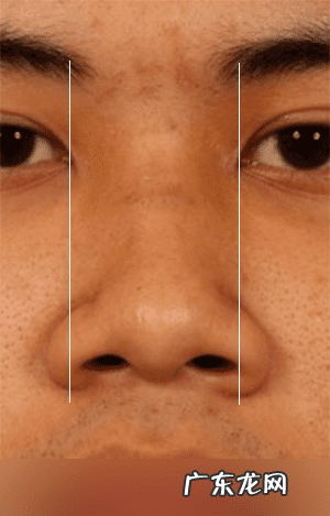 怎样能使鼻子变小 让鼻子变小的方法