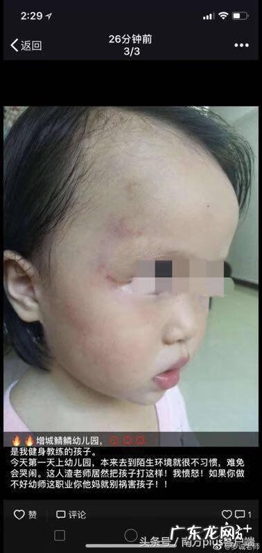 虐童事件幼师的感悟 幼儿园虐童事件对幼儿的影响