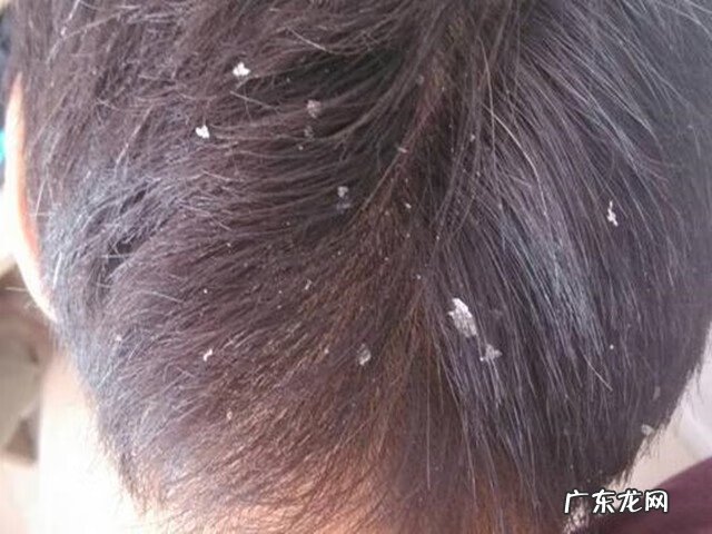 皮肤病与家庭风水有关吗 皮肤痒与家的风水有关吗?