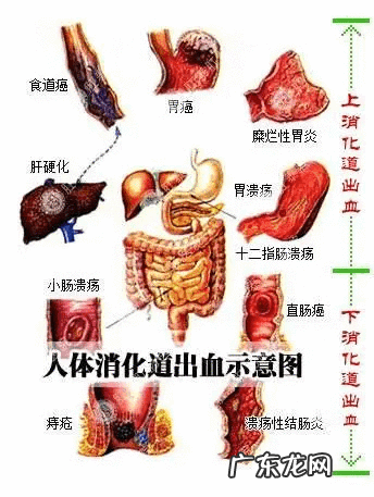 大便黑色的怎么回事 大便是黑色的咋回事要怎么调理