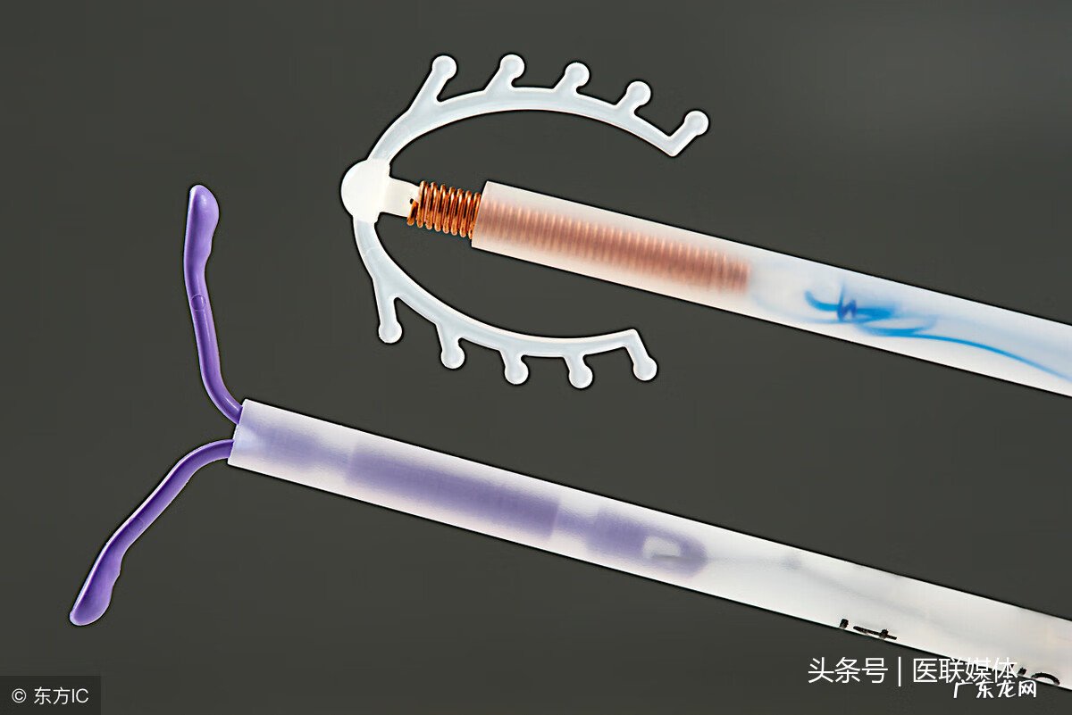 女人带环对身体有害吗 上环对身体有影响么