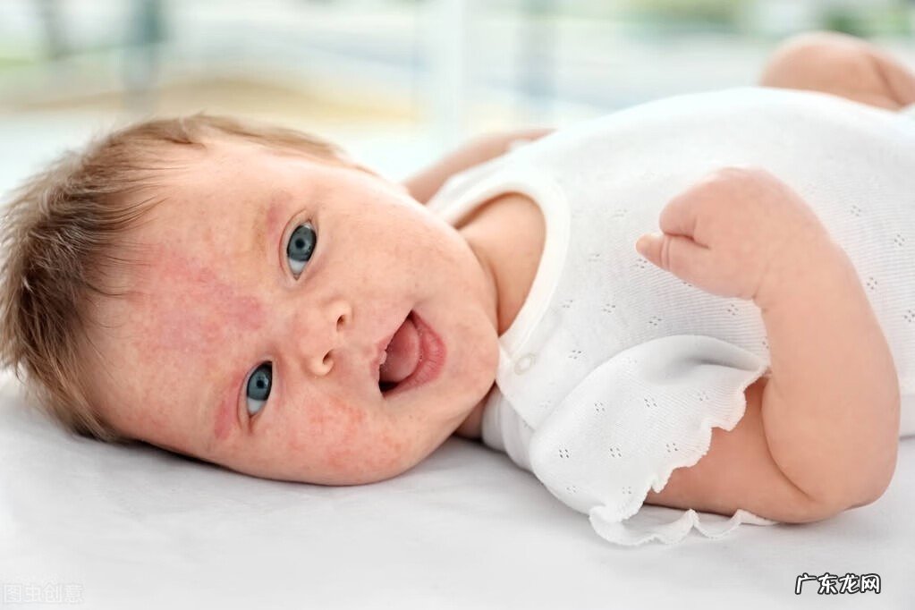新生儿长湿疹用什么药最有效 新生儿湿疹用什么药?