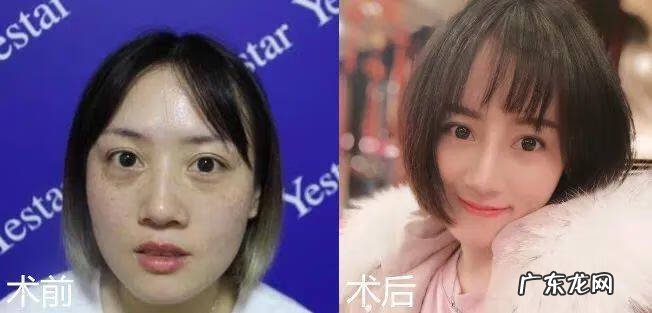 男士激光祛斑多少钱 激光祛斑多少钱呢