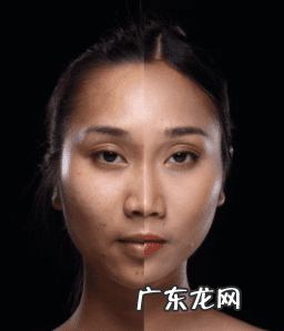 消除黄褐斑最好的方法有什么 去除黄褐斑的有效方法