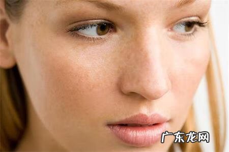 雀斑用什么激光效果最好 激光祛雀斑能彻底去掉吗