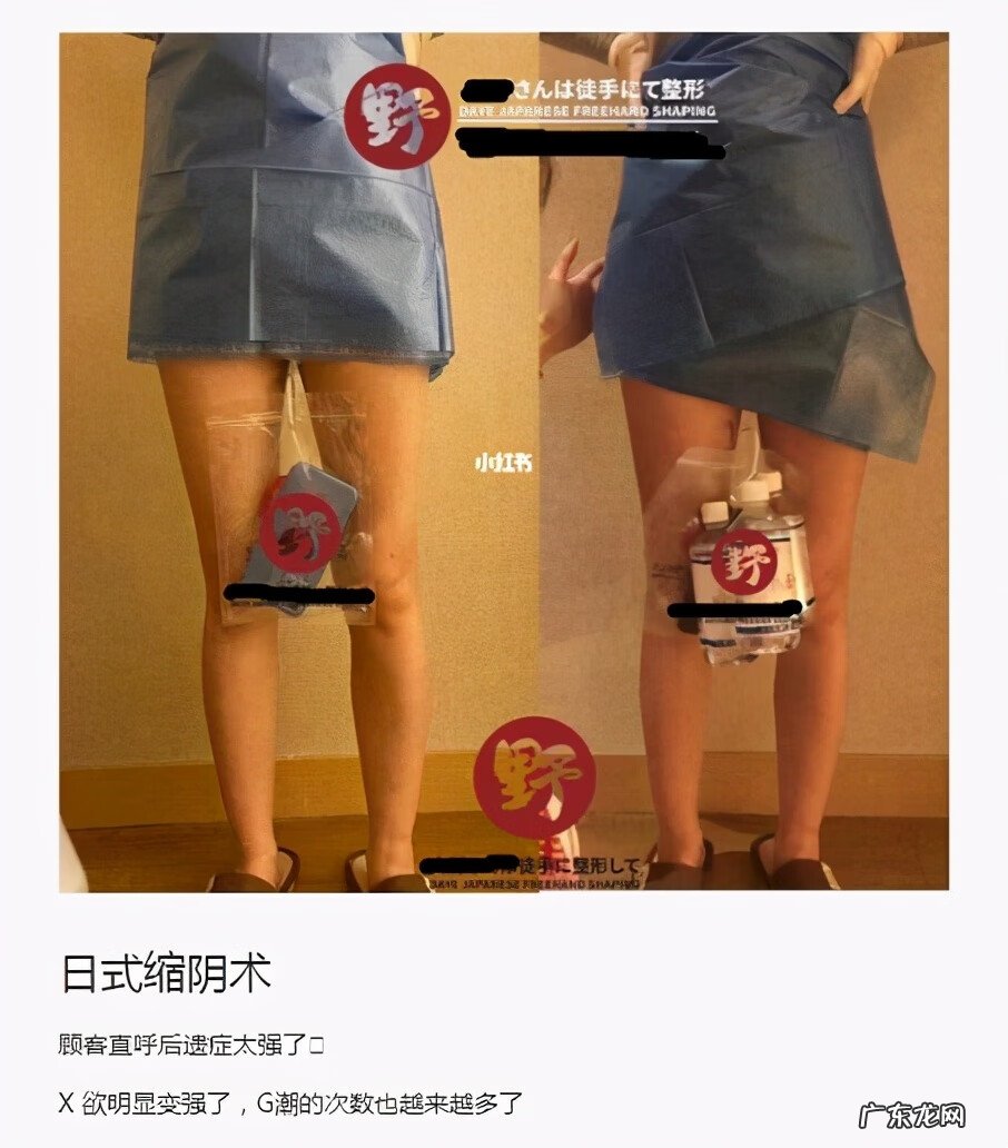 收缩哑铃有用过的吗 缩阴哑铃真的管用吗