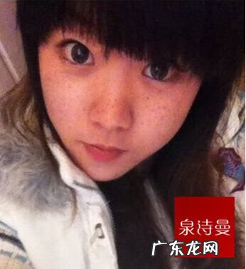 6种祛斑最好的方法 最有效祛斑的方法