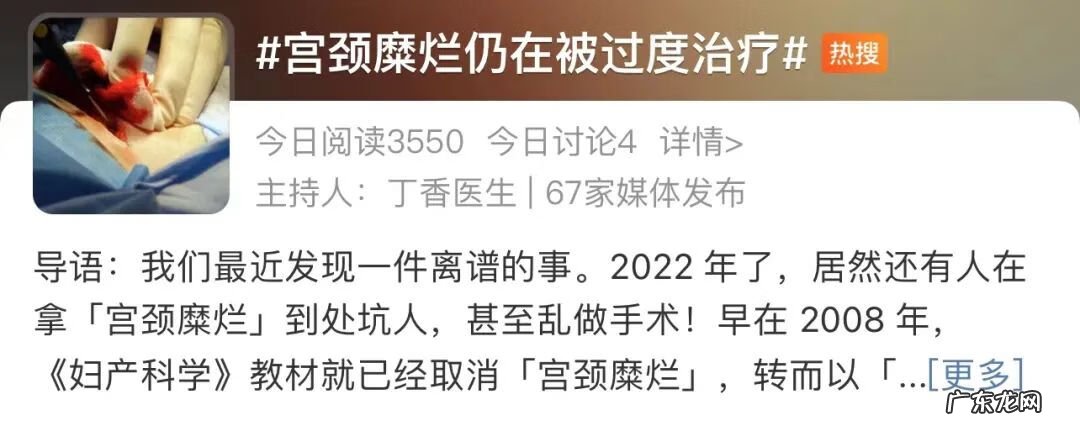 女性护阴胶囊 女性缩阴用品