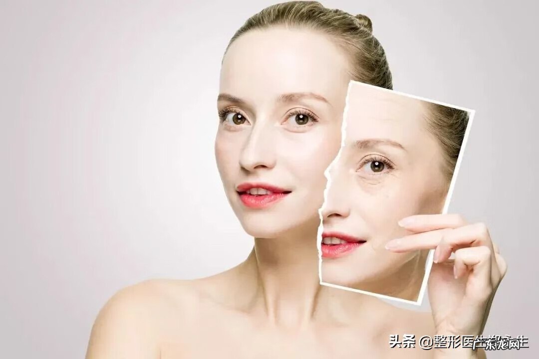 怎样让皱纹消除 怎样除皱纹小窍门