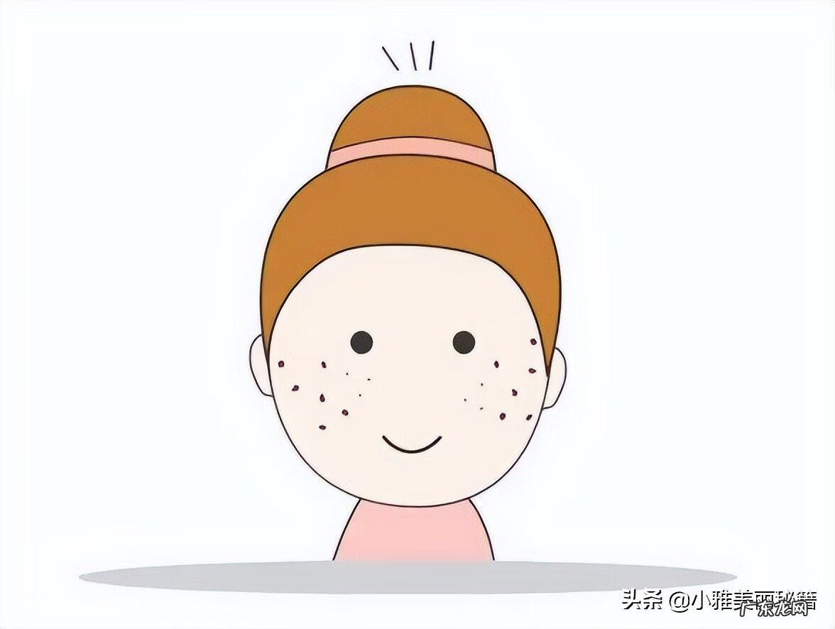 什么化妆品祛斑效果最好 什么祛斑产品效果最好