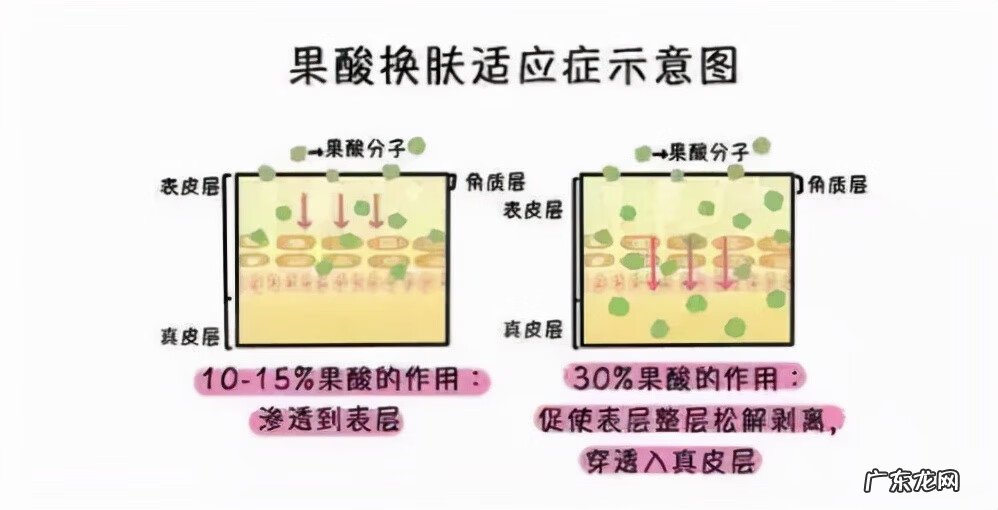 面部有痤疮怎么治 治疗面部痤疮疤痕