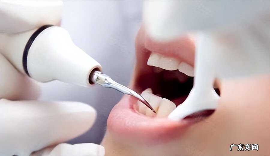 洗牙会对牙齿造成什么伤害吗 洗牙对牙齿有害吗?会损伤牙齿
