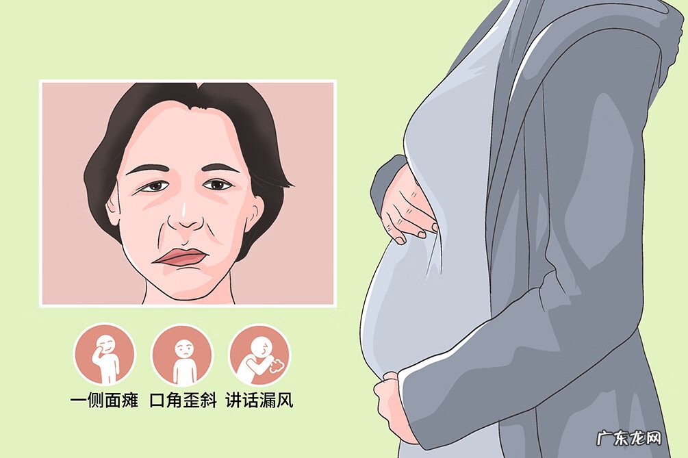 什么原因导致的面瘫 面瘫的病因病理