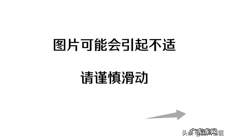 牙齿整形价格需要多少钱 牙齿整形一般多少钱啊