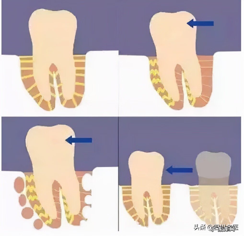 牙齿整形价格需要多少钱 牙齿整形一般多少钱啊