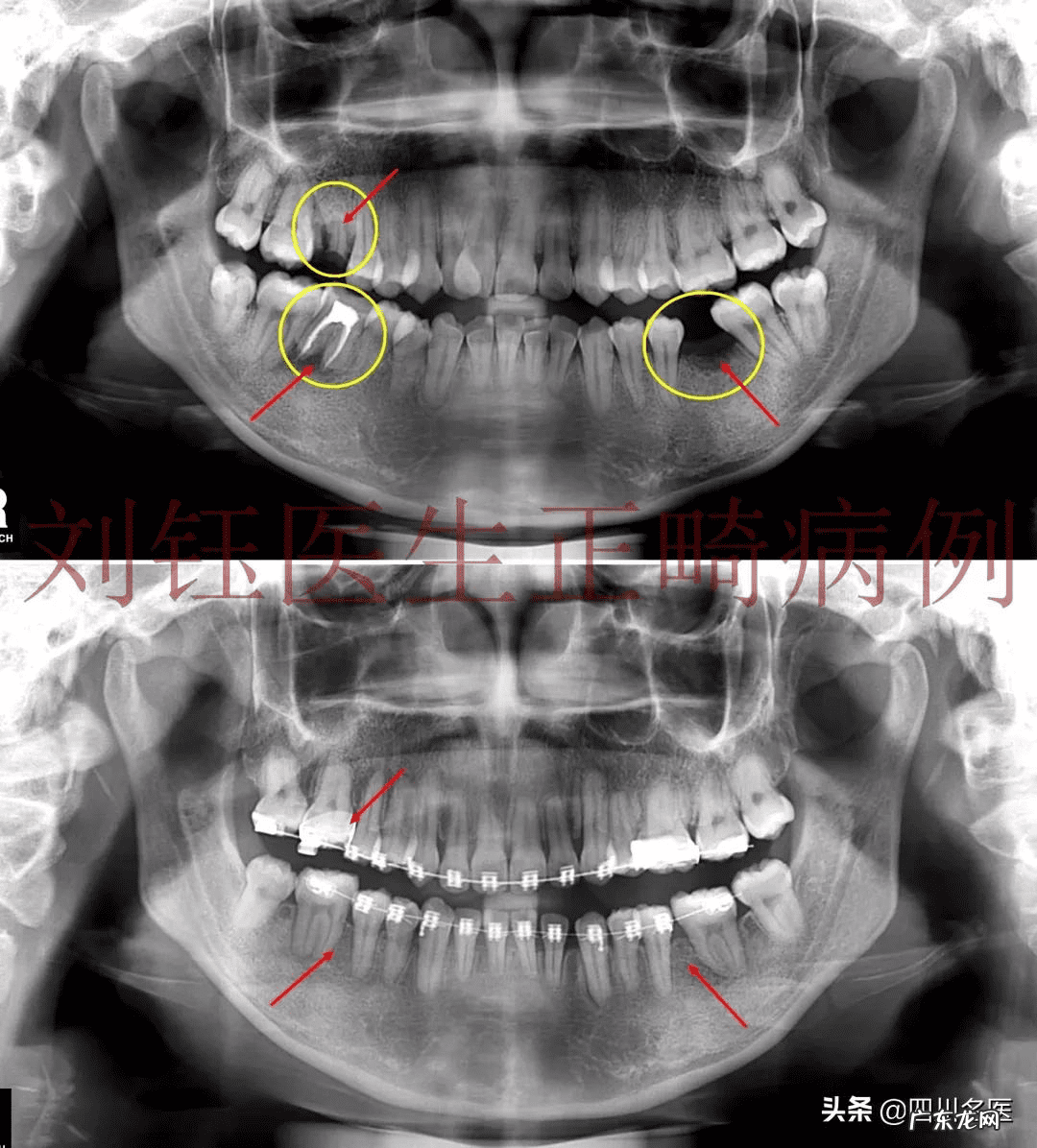 牙齿整形价格需要多少钱 牙齿整形一般多少钱啊
