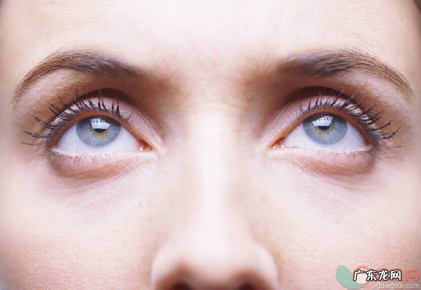 眼袋是什么样的图片 眼袋的形成原因