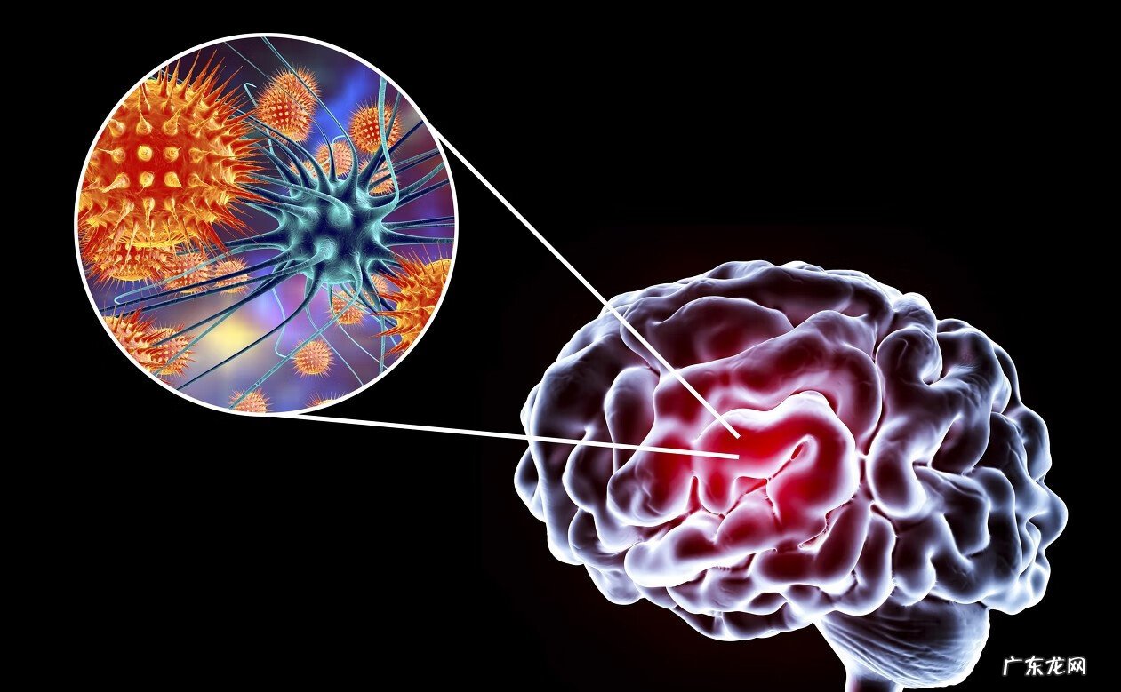 大人得脑膜炎严重吗 急性脑膜炎严重吗